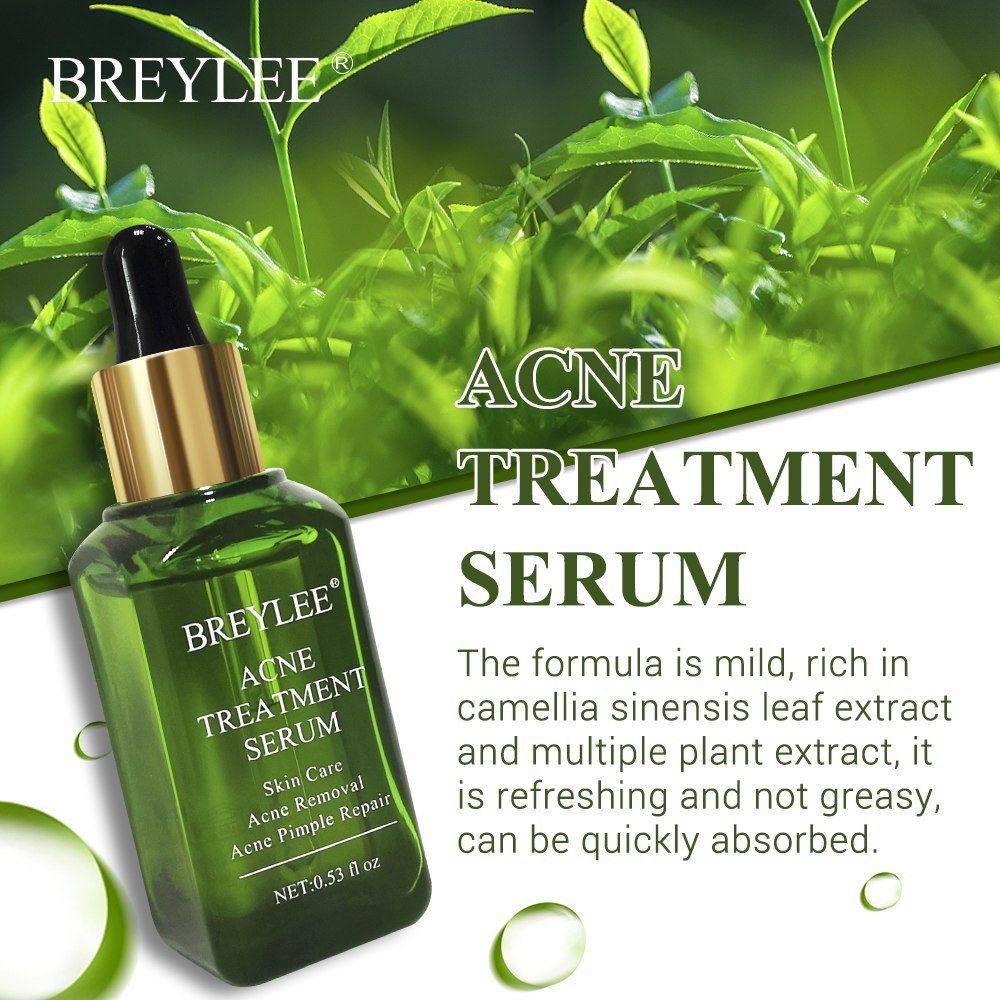 Acne Treatment Serum