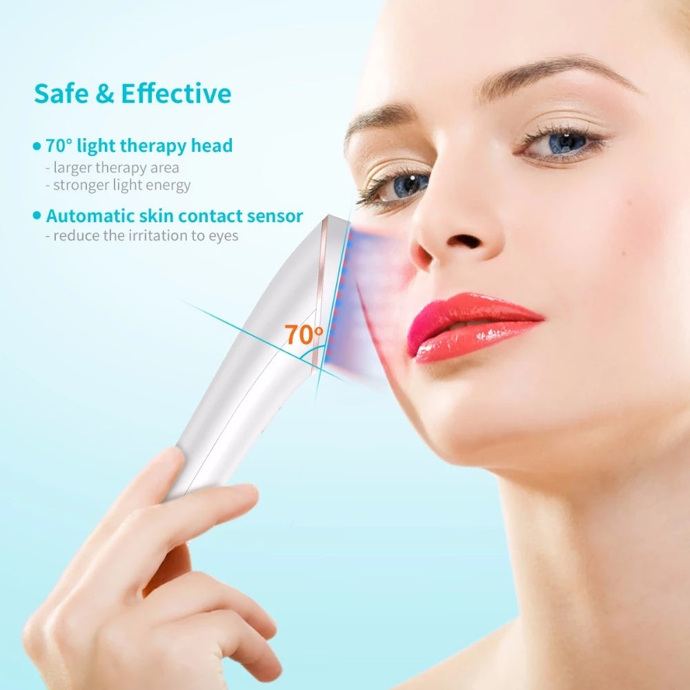 Acne Treatment Device